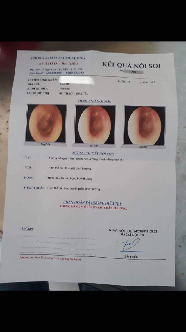 Cháu T. được kết luận bị thủng màng nhĩ sau khi bị các bạn đánh hội đồng. Ảnh do gia đình cung cấp.