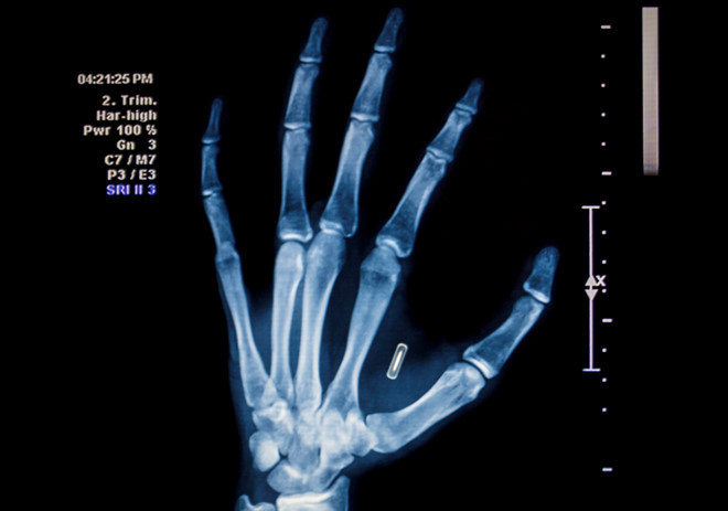 Tương lai con người trở thành cybor - nửa người nửa máy đang đến gần? Ảnh: Engadget.