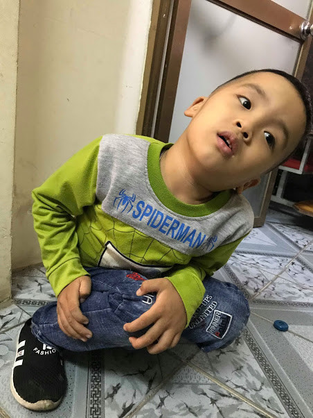 Bé Nguyễn Hữu Hào Hùng (5 tuổi, quê ở Hưng Yên) ngày nào cũng phải mất 4 tiếng đi từ quê lên Hà Nội để học. Trong hình bé được các cô cho ngồi xổm( 2 tay để lên đầu gối, ngồi yên một chỗ khoảng 5-10 phút) sau mỗi khi giờ học kết thúc. Qua biện pháp này, bé bớt cau có và nghịch ngợm, không tập trung.Đây là phương pháp tâm lí giúp bé rèn được bệnh tăng động giảm chú ý