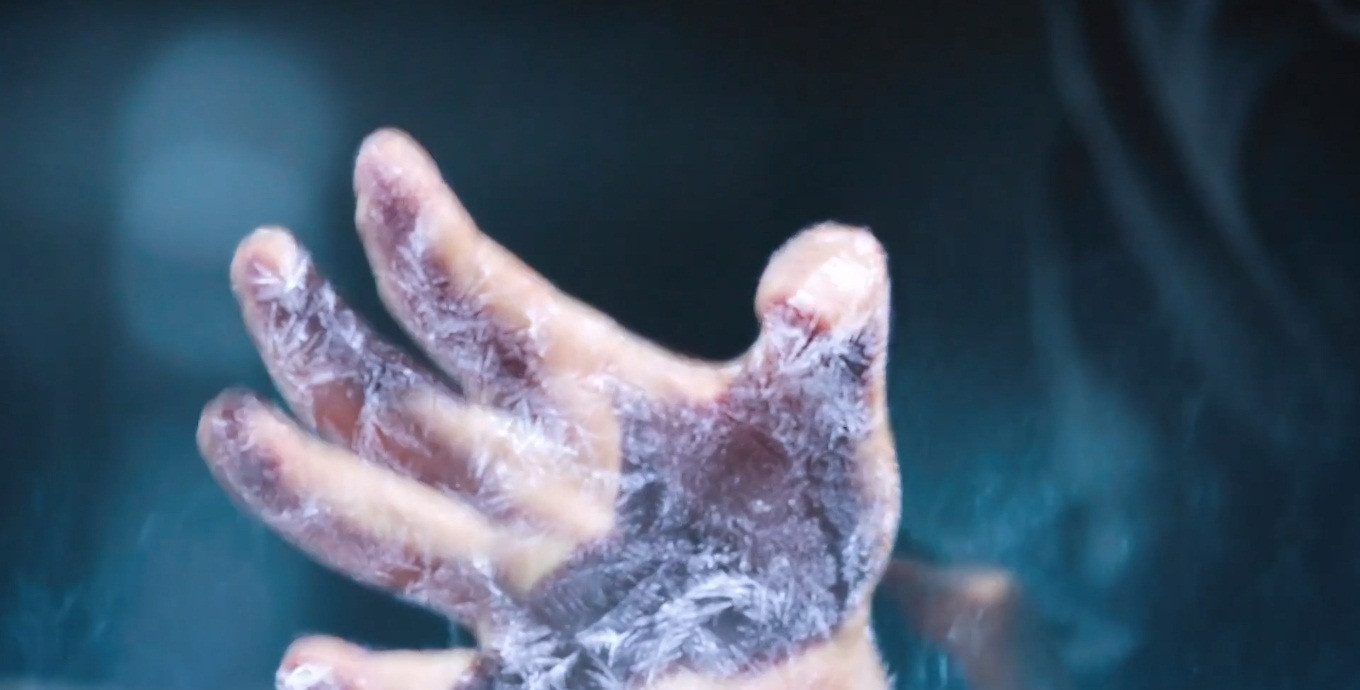 Cận cảnh bàn tay bị phản phệ nè! Xin lỗi Húc Phượng, lẽ ra phải xót xa Phượng Hoàng lắm mà nhìn bàn tay không nén được phải... phì cười.