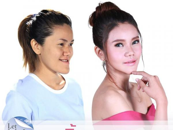 Phẫu thuật thẩm mỹ đã thay đổi số phận một người như thế nào? ảnh 8