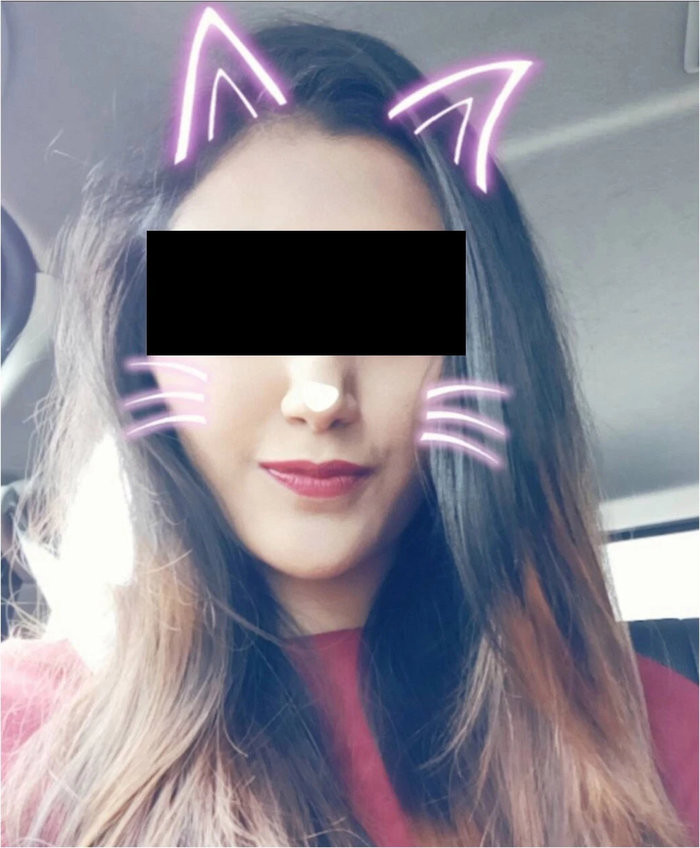 Bộ lọc hình mèo dễ thương này có thể khiến bạn mất lượng lớn lượt thích. (Ảnh: sciencedirect)