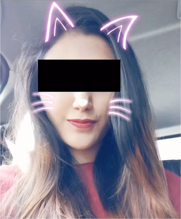 Bộ lọc hình mèo dễ thương này có thể khiến bạn mất lượng lớn lượt thích. (Ảnh: sciencedirect)