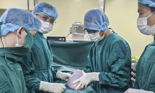 Cắt bỏ thành công khối u buồng trứng 'khổng lồ' nặng 5,5 kg