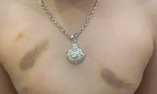 Buộc thôi việc, phạt tiền cô giáo bị tố bạo hành trẻ mầm non