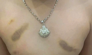 Buộc thôi việc, phạt tiền cô giáo bị tố bạo hành trẻ mầm non