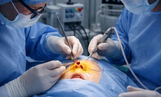 Phẫu thuật phục hồi thành công ca biến chứng sau nâng mũi bằng silicon