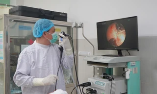 Đà Nẵng: Răng giả rơi vào phổi người đàn ông suốt 20 năm, liên tục gây viêm sốt 