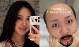 'Nữ chủ tịch văn hóa Hàn Quốc' mất 4.000 người theo dõi sau khi đăng ảnh bị bật long móng