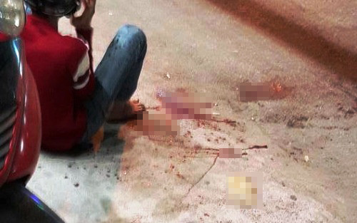 Nam thanh niên bị chém đứt lìa bàn tay chờ được đưa đi cấp cứu. Ảnh: Thành Ngô