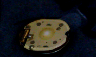 "Vật lạ" được gắn trong áo bé Minh là chíp điện tử nhằm phát sáng?