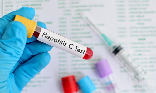 12 dấu hiệu cảnh báo bạn nhiễm virus viêm gan C