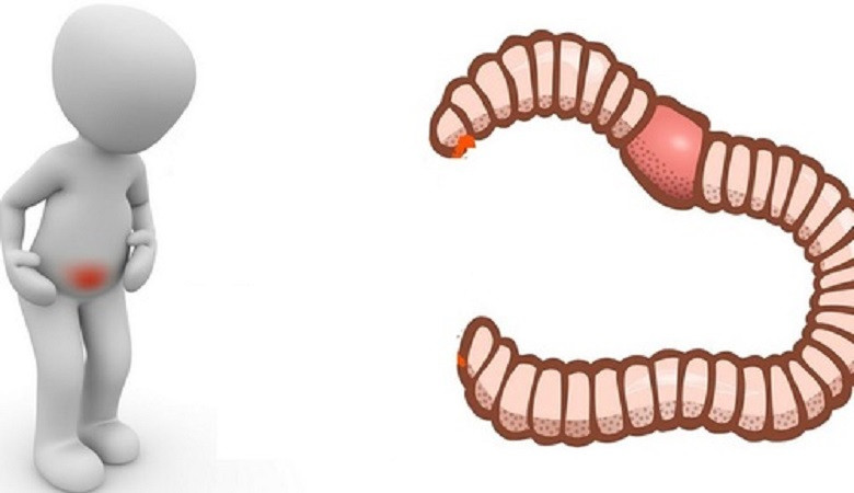 10 dấu hiệu nhận biết người bị nhiễm sán dây