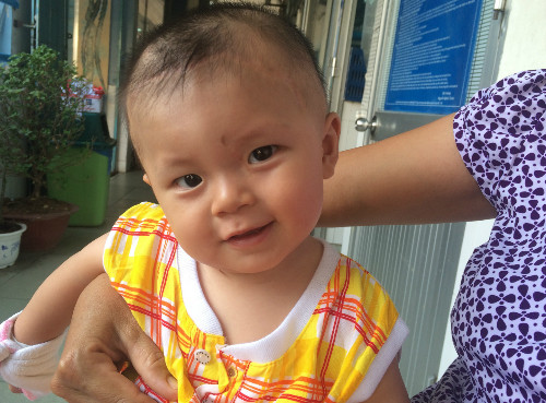 Bé sẽ được theo dõi sát trong 3 năm đầu đời. Ảnh: Lê Phương.