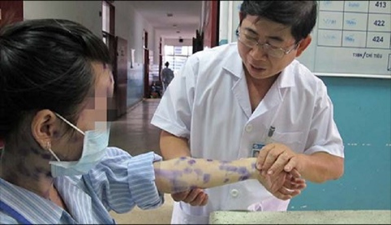 Cách phòng tránh những mối nguy hại từ thời tiết nồm ẩm