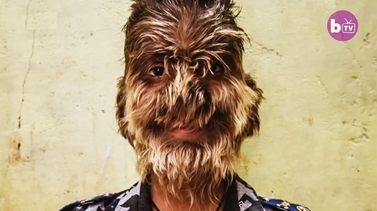 Ước mơ giản dị khó thành hiện thực của cậu bé 'ma sói'