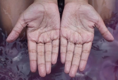 Lý do ngón tay bị nhăn khi ngâm nước