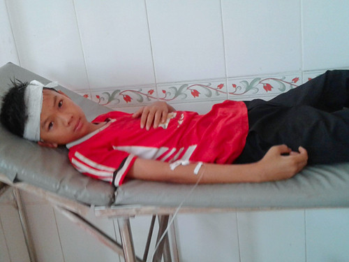 Em Hùng phải băng bó đầu, khâu 4 mũi khi bị quạt trần rơi trúng. Ảnh: Đ.H