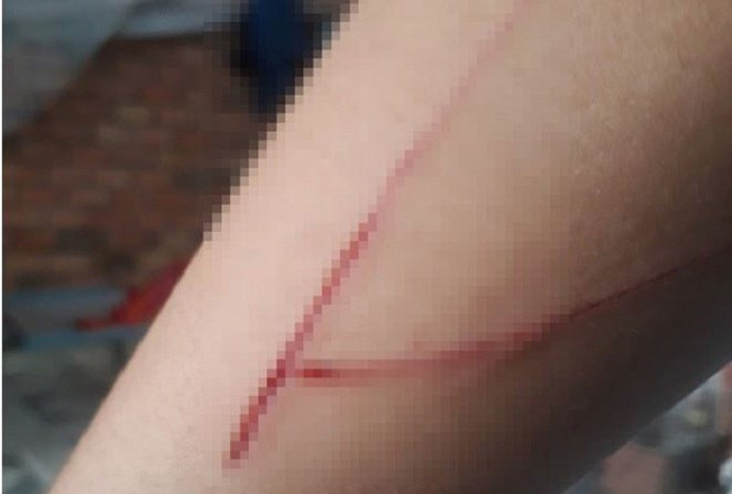 Sự thật thông tin 'nạn nhân vụ giao cấu với trẻ em bị chém trên đường'