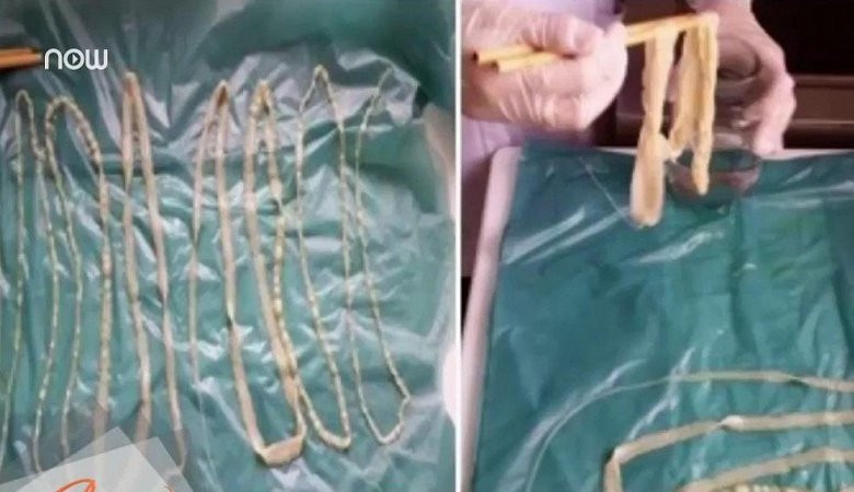 Nguyên tắc sống còn trong ăn uống để không mắc sán lợn