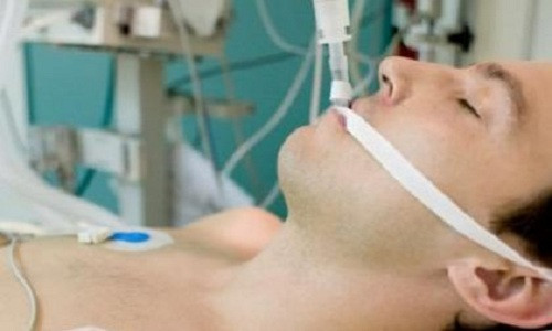 Một bệnh nhân hôn mê sâu phải dùng máy trợ thở. Ảnh minh họa: Telegraph.