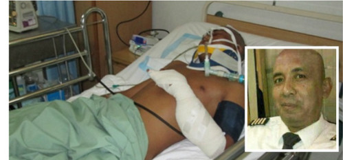 Người đàn ông bị băng bó trong ảnh được xác nhận là một người Myanmar chứ không phải là phi công MH370. 