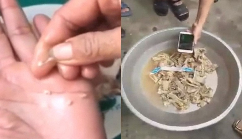 Không còn mẫu thịt nghi nhiễm sán lợn ở trường mầm non Bắc Ninh để điều tra