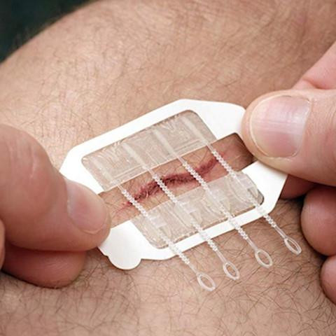 Miếng dán tiện lợi giúp khép vết thương hở mau hơn