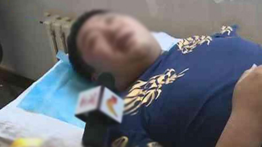 Méo miệng, mặt lệch sau một đêm vì thói quen trong ngày nắng nóng