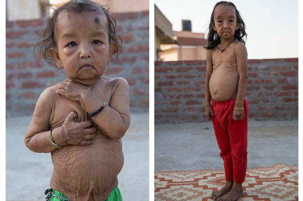 Anjali (phải) và Keshav (trái). Ảnh: Cover Asia Press.