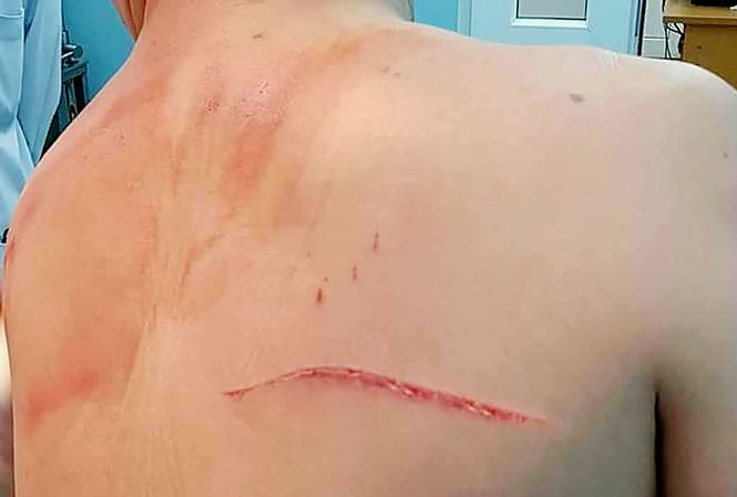 Vợ bác sĩ thẩm mỹ bị bắt vì nghi thuê người chém chồng