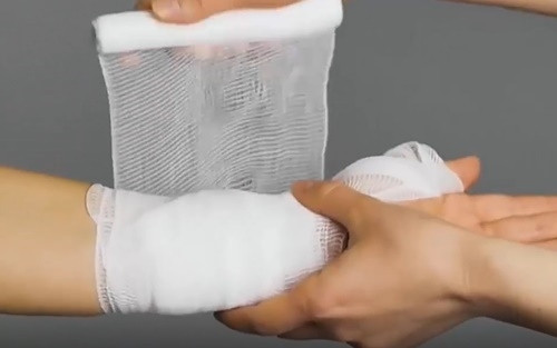 Mẹo hay: Học ngay cách sơ cứu vết thương tại nhà