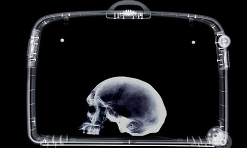 Máy quét an ninh phát hiện có hộp sọ người trong hành lý của ông giáo sư. Ảnh: Stuff