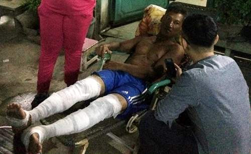 Anh Phi vào giúp chị Trang lấy giấy tờ cũng bị bỏng nặng ở hai chân. Ảnh: Hải Hiếu