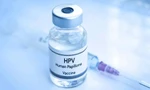 Những điều cần biết về tiêm vắc-xin HPV từ sớm và mẹo chăm sóc "cô bé" đúng cách