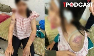 NÓNG 20/11: Bé gái bị gia đình nội tra tấn: Đây là hành vi nghiêm trọng