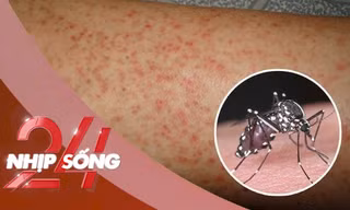 NHỊP SỐNG 24: Vì sao Chikungunya dễ nhầm với sốt xuất huyết?