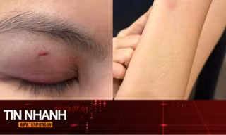 TIN NHANH: Luật sư nhận định vụ ca sĩ Trung Quân Idol bị tố đánh phụ nữ