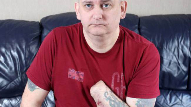 Rùng rợn người đàn ông tự chặt tay mình