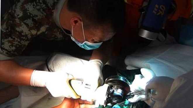 Giải cứu người đàn ông mắc kẹt 'của quý' trong ống thép