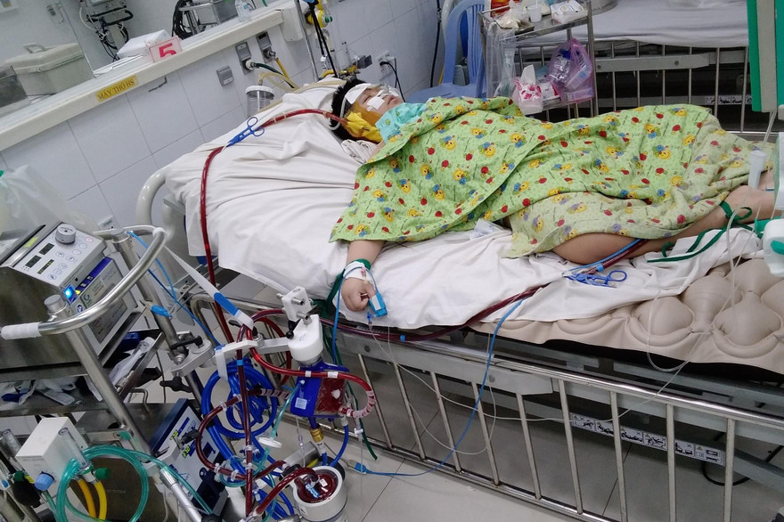 Bé trai béo phì mắc COVID-19 nguy kịch vì 'bão Cytokine'