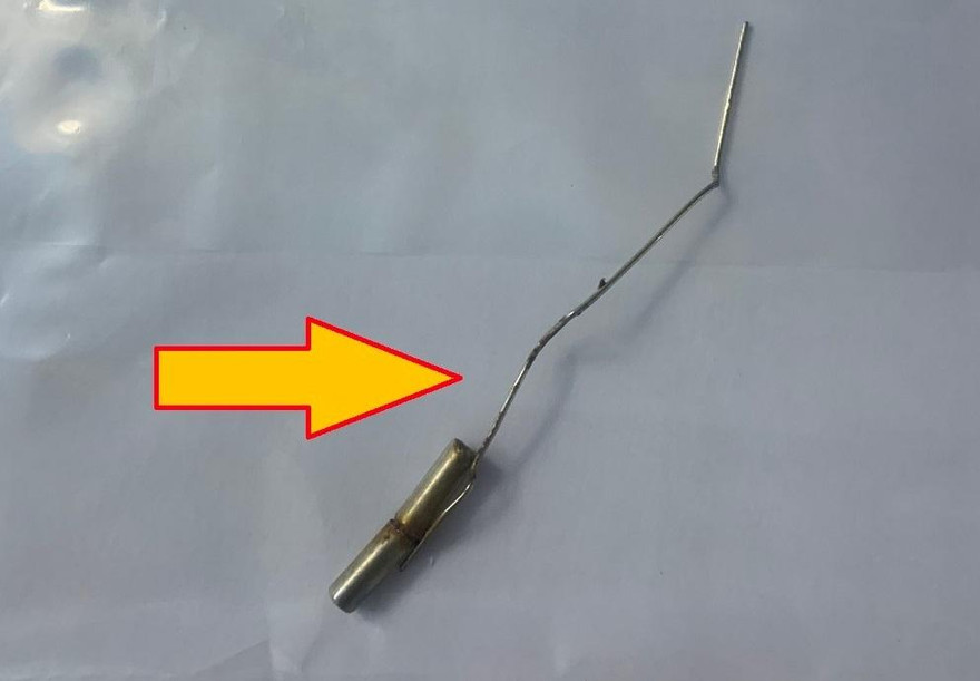 Cậu bé 10 tuổi tự nhét que sắt và thỏi nam châm vào dương vật