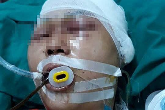 Nam sinh Hồng Quốc Anh vẫn hôn mê, sống thực vật sau hơn 2 tháng điều trị