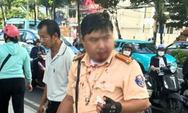 Cán bộ CSGT ở Nha Trang bị người nước ngoài đấm chảy máu miệng khi đang làm nhiệm vụ