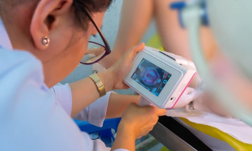 Bệnh viện đầu tiên tại Việt Nam tầm soát ung thư cổ tử cung bằng trí tuệ nhân tạo