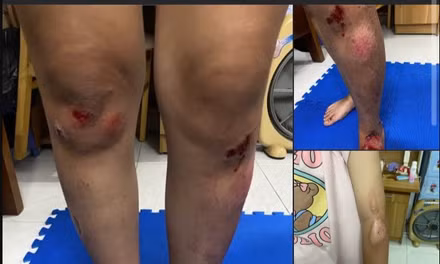 Công an xác minh thông tin vụ 2 cô gái bị đánh sau va chạm giao thông