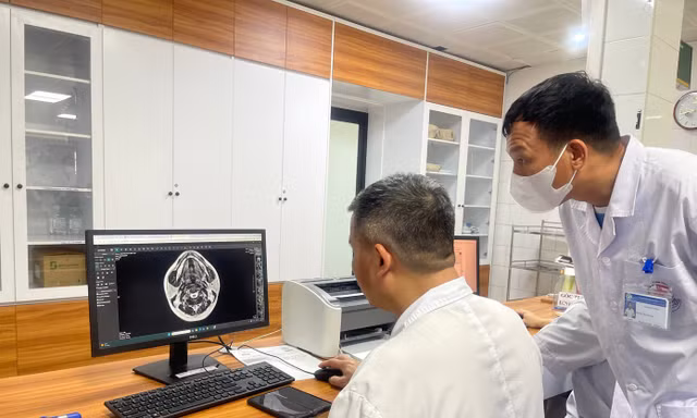 Các bác sĩ quan sát tổn thương trên não bệnh nhân do sử dụng bóng cười 