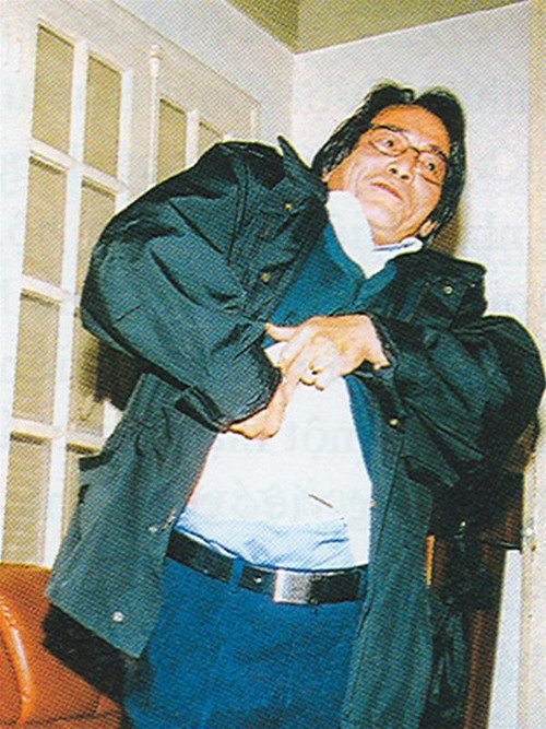 Anh Mai Bốn vạch áo để lộ vết sẹo do mổ bụng để uy hiếp kẻ thù