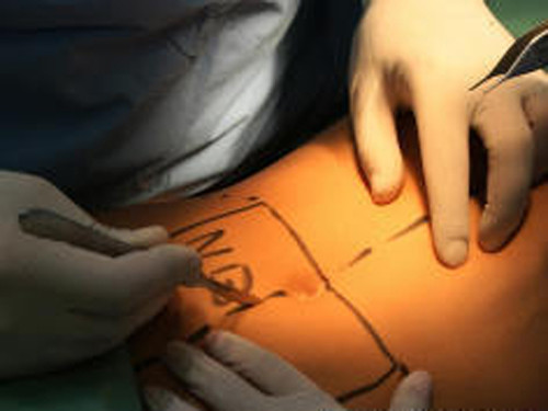 Hình minh hoạ. Ảnh: Getty