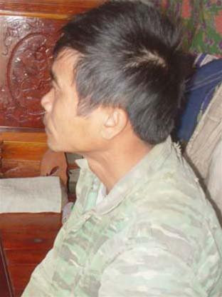 Bệnh nhân Hà Quyết Thắng